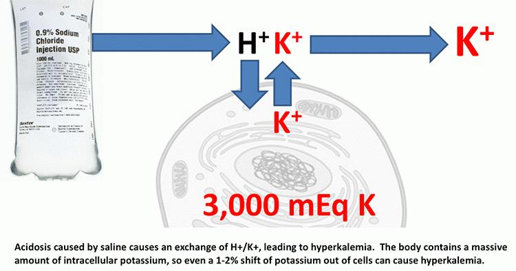 can cause kidney injury Hyperchloremia causes renal vasoconstriction SALT ED trial NEJM