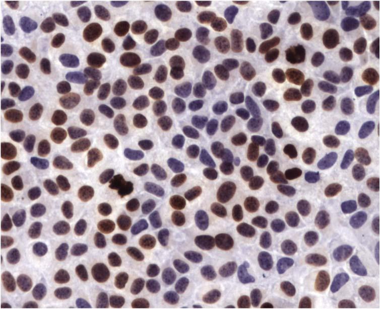 AML12 cells were growth arrested, treated with BrDU and