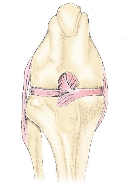 The menisci have several important functions, including energy absorption and stress transfer across the stifle joint, joint stabilization, prevention of synovial membrane (joint capsule) impingement