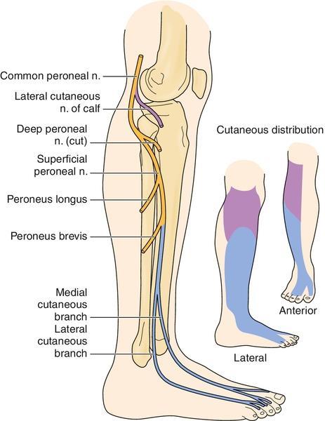 Course of the common peroneal nerve The nerve divides into superficial and deep branches Note the that the deep branch winds round the neck of the fibula It is vulnerable to damage from fractures of