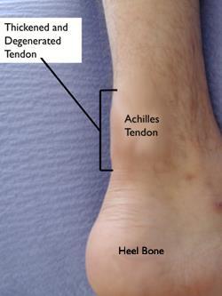 Signs and symptoms Obvious swelling of the affected area Pain on