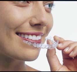 between eighteen and thirty. For some people, a combination of braces and clear trays are successful, requiring less time than traditional braces.