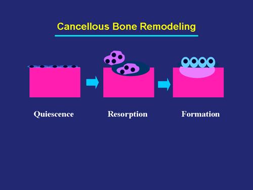 Osteoblasts Balanced Imbalanced Increased Remodeling Rate Imbalanced Remodeling Quiescence Resorption Formation Increased