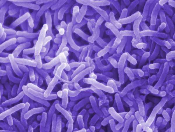 Cholera Disease acquired by drinking contaminated water (w/human feces) Bacteria (Vibrio