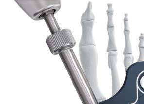 0 mm drill bit Precaution: Pre-drilling for self-drilling screws is