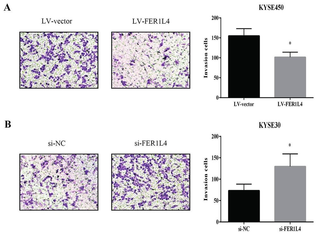 The role of LncRNA FER1L4 in esophageal squamous cell carcinoma Figure 4. LncRNA FER1L4 inhibited ESCC cell invasion in vitro.