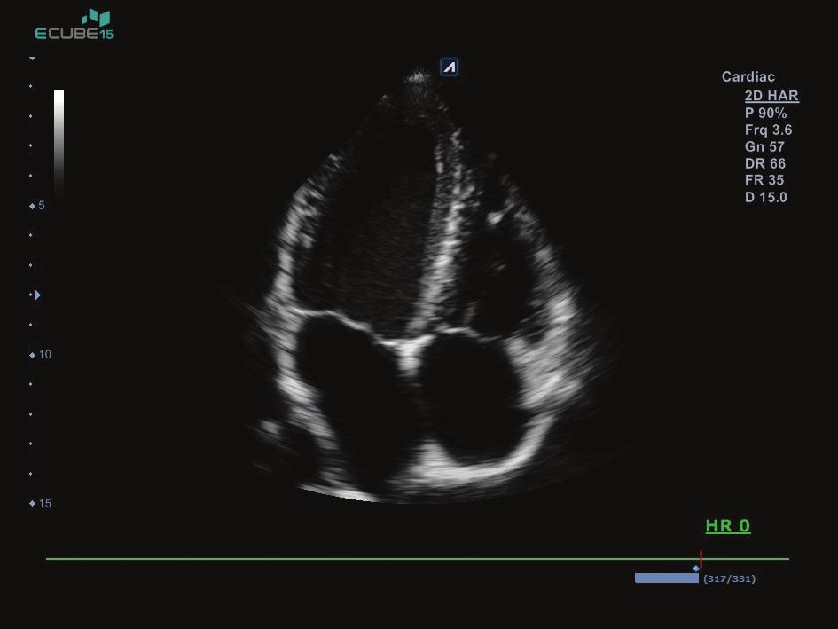 Imaging performance with advanced features Cardiovascular - Enhanced