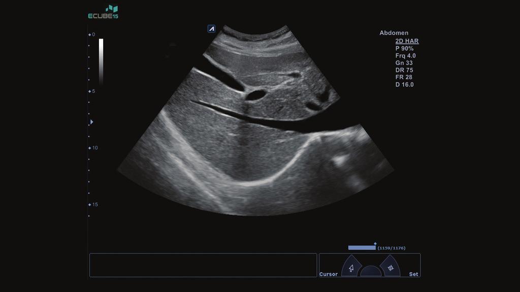 General Imaging & Small Parts - Unparalleled image quality in B-mode, Color Flow, and Doppler