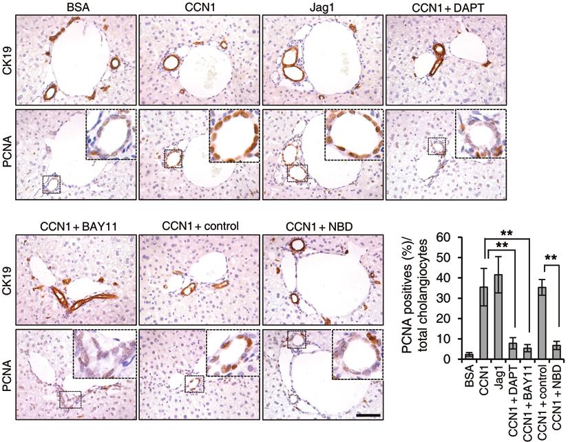 Figure 7. CCN1 induces cholangiocyte proliferation through NF-κB and NOTCH signaling in vivo. Adjacent liver sections of WT mice injected with CCN1 (1 mg/kg), soluble JAG1 (0.