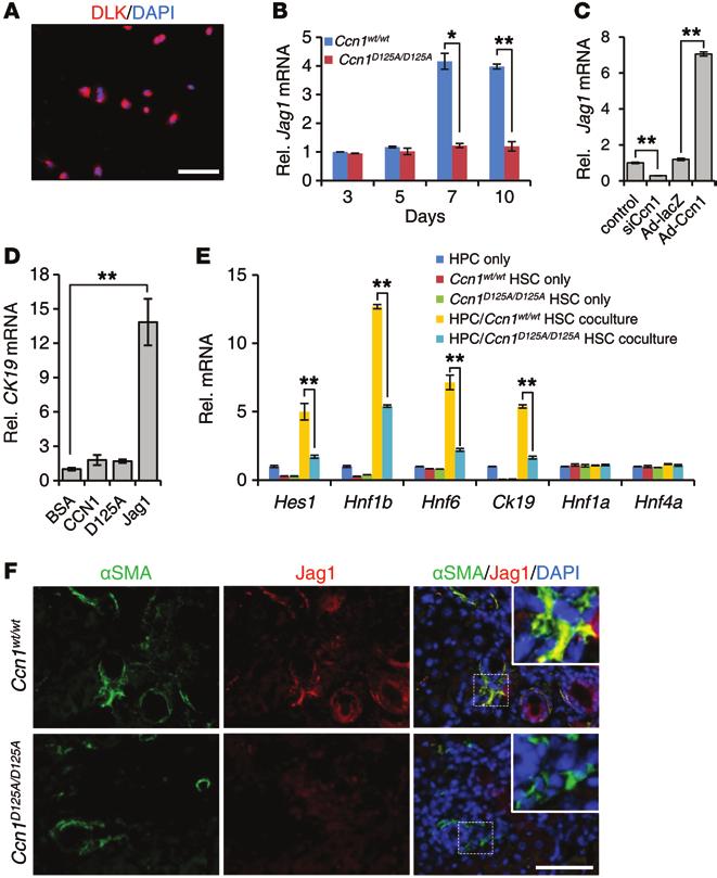Figure 8. Ccn1 D125A/D125A HSCs are impaired in Jag1 expression and promotion of HPC differentiation to cholangiocytes.