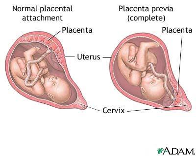 Placenta The placenta anchors the developing fetus to the uterus and provides a bridge for