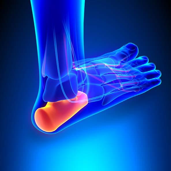 Chronic Injuries Plantar Fasciitis Plantar Fasciitis is inflammation of the plantar fascia - a thick, fibrous ligament that runs under the foot from the heel bone to the toes.