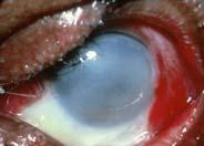 Surgery is not always indicated Arranging Ophthalmology follow up for possible surgical repair Surgery is most commonly performed after 7 14days Indications for surgery Entrapped muscle, symptomatic
