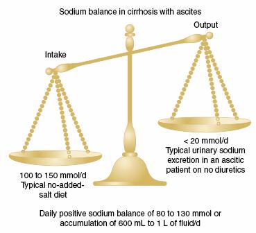 Management of Ascites Sodium Restriction Mandatory at all stages
