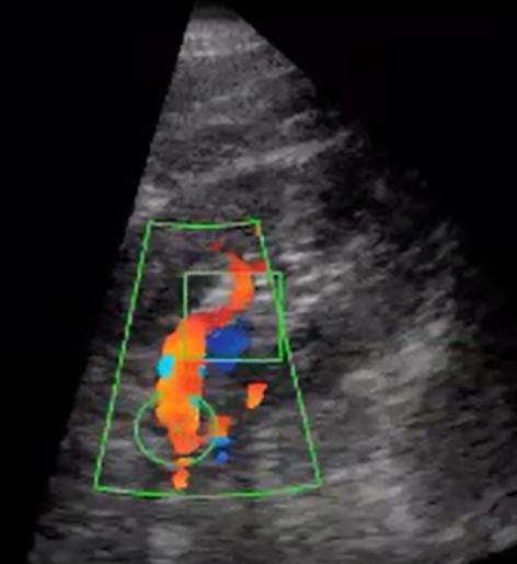 ultrasound image and motion