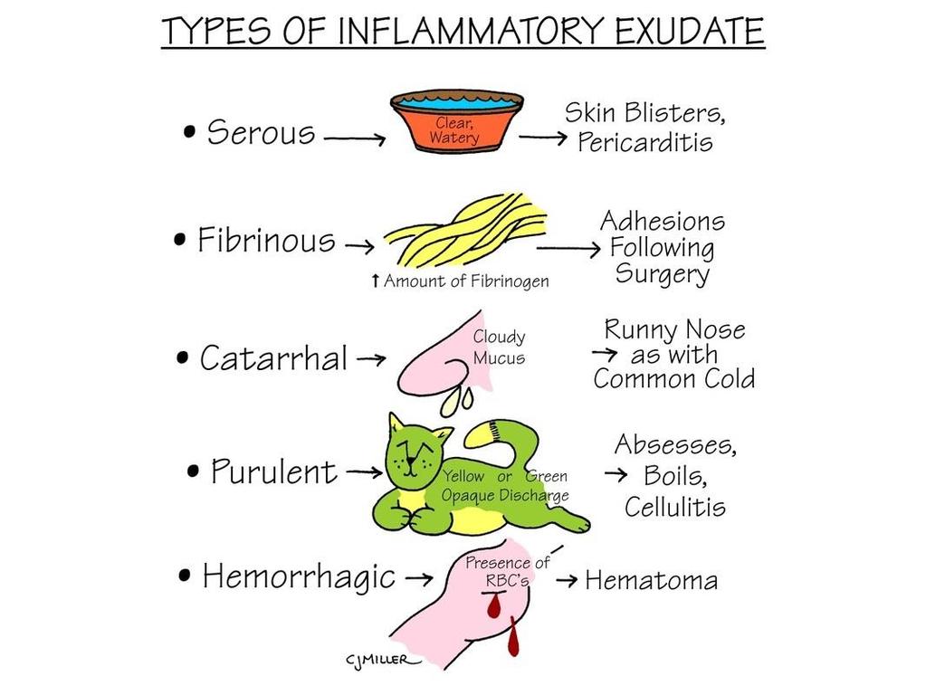 Types of wound exudate Material such as fluid and cells that have escaped from blood vessels during inflammatory process Deposited in tissue or on tissue