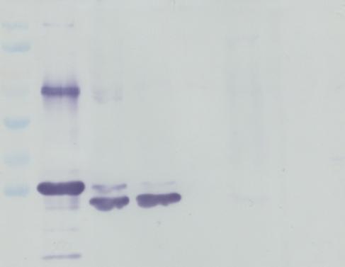 EGFP gene, and (lane 2) recombinant bacmid expressing only EGFP. B.3 Recombinant VP28 protein Western blot analysis was performed to detect recombinant VP28 protein.