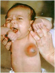 Diseases of newborns 9 Figure 1.