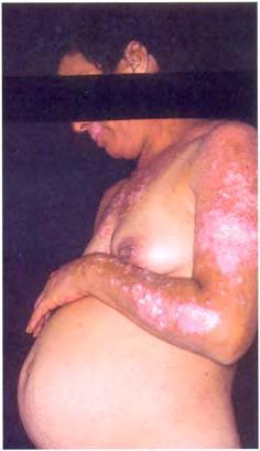 Pregnancy-related diseases and conditions 235 Figure 26.