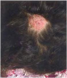 Disorders of the hair and the scalp 51 Figure 6.