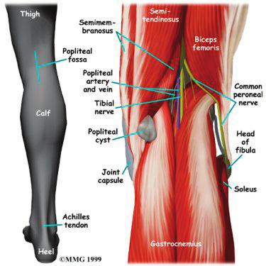 A popliteal cyst is a small, bag-like structure that forms when the joint lining produces too much fluid in the knee.