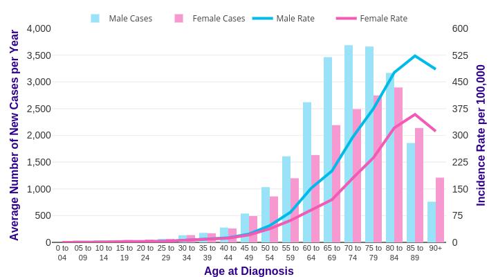 UK 2013-15 Bowel Cancer age at diagnosis Europe