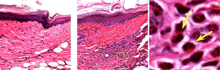 Extrcellulr mtrix in the dermis ws detected y SHG signls (lue). dilc2 shown in green.