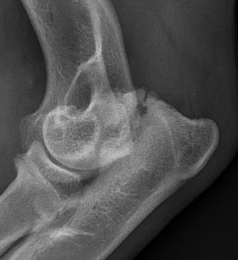 Ununited Anconeal Process (UAP Separate ossification center in large breeds Bone union between 15-20 weeks