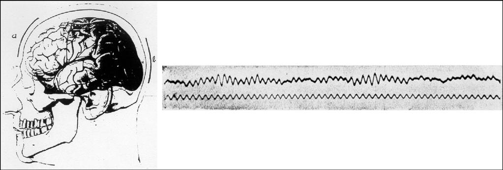 one of Berger s recordings Figure 1. One of the first recordings of an electroencephalogram (EEG).