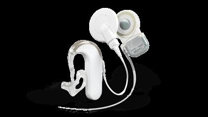 EAS Hearing Implant System for Partial Deafness Middle Ear Implant System for Sensorineural or Conductive and Mixed Hearing Losses Electric Acoustic Stimulation (EAS) is a modification of the
