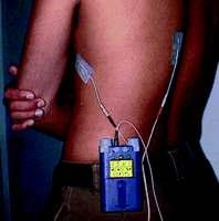 affected part, through application of heat, cold, or chemicals, to acupuncture or transcutaneous electrical nerve stimulation.