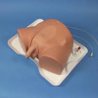 Connect the Fluid Bag to the bladder feed tube (with the white connector,