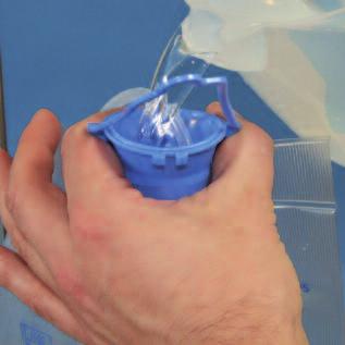 Open the cap on the top of the Fluid Bag and place the air vent tube (tube