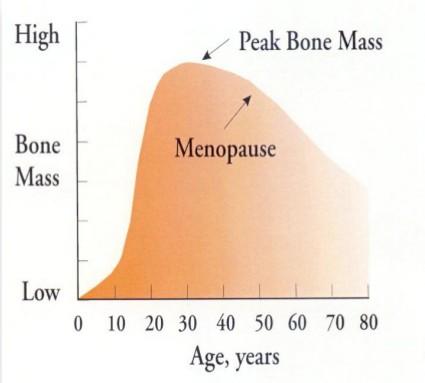 Female Women after menopause lose bone mass much faster than men Burden of Disease- India Based on 2001 census: 163 million