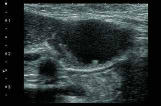 The contrast enhanced ultrasound with time arrival parametric imaging (Fig.