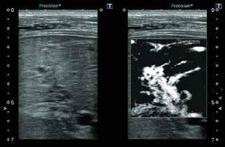 Conclusion There are several options for using ultrasound to evaluate vascular structures.