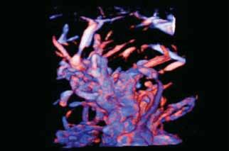 With 3D SMI, the entire vascular structure in an area of interest can be visualized, potentially