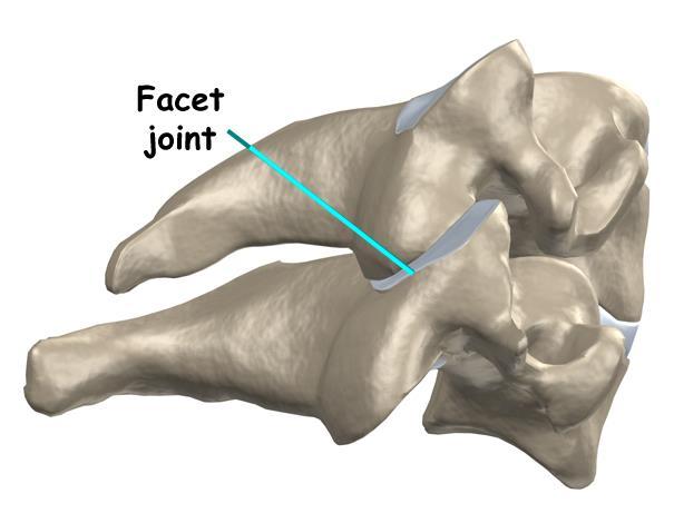 FACET JOINTS Joints of the spine Connect each vertebrae with the