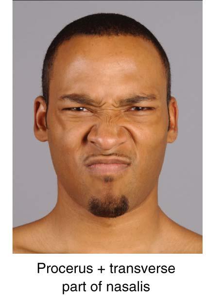 2-1 Nasalis Face: Muscles