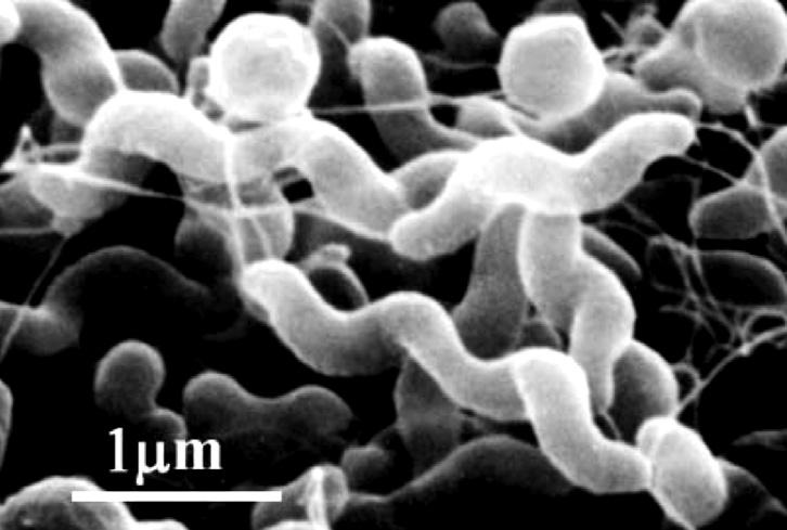 They can move rapidly due to having a whip-like flagellum at one end which acts like a ship s propeller. Why have so few people heard about Campylobacter?