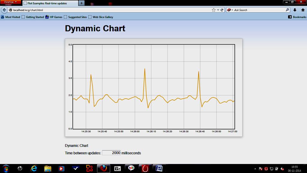 Figure 7. ECG signal plotted in the browser of the laptop configured as server Figure 8. Screen shot of the potted ECG waveform in the web browser 10.