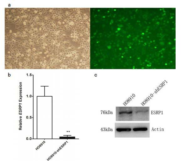 A down-regulation of ESRP-1 in human ovarian cancer cell line