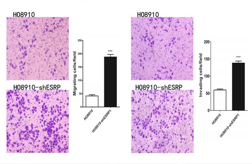 A B C There was no significant change in cell proliferation between HO8910 and HO8910-shESRP1 (A,CCK-8, P=0.