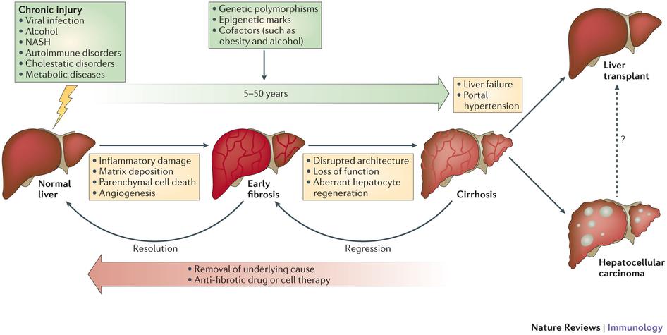 Progression of Chronic Liver Disease Pellicoro A,