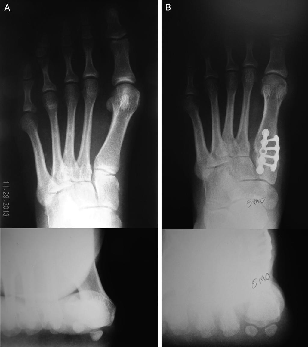 P. Dayton et al. / The Journal of Foot & Ankle Surgery xxx (2015) 1 10 9 Fig. 12.