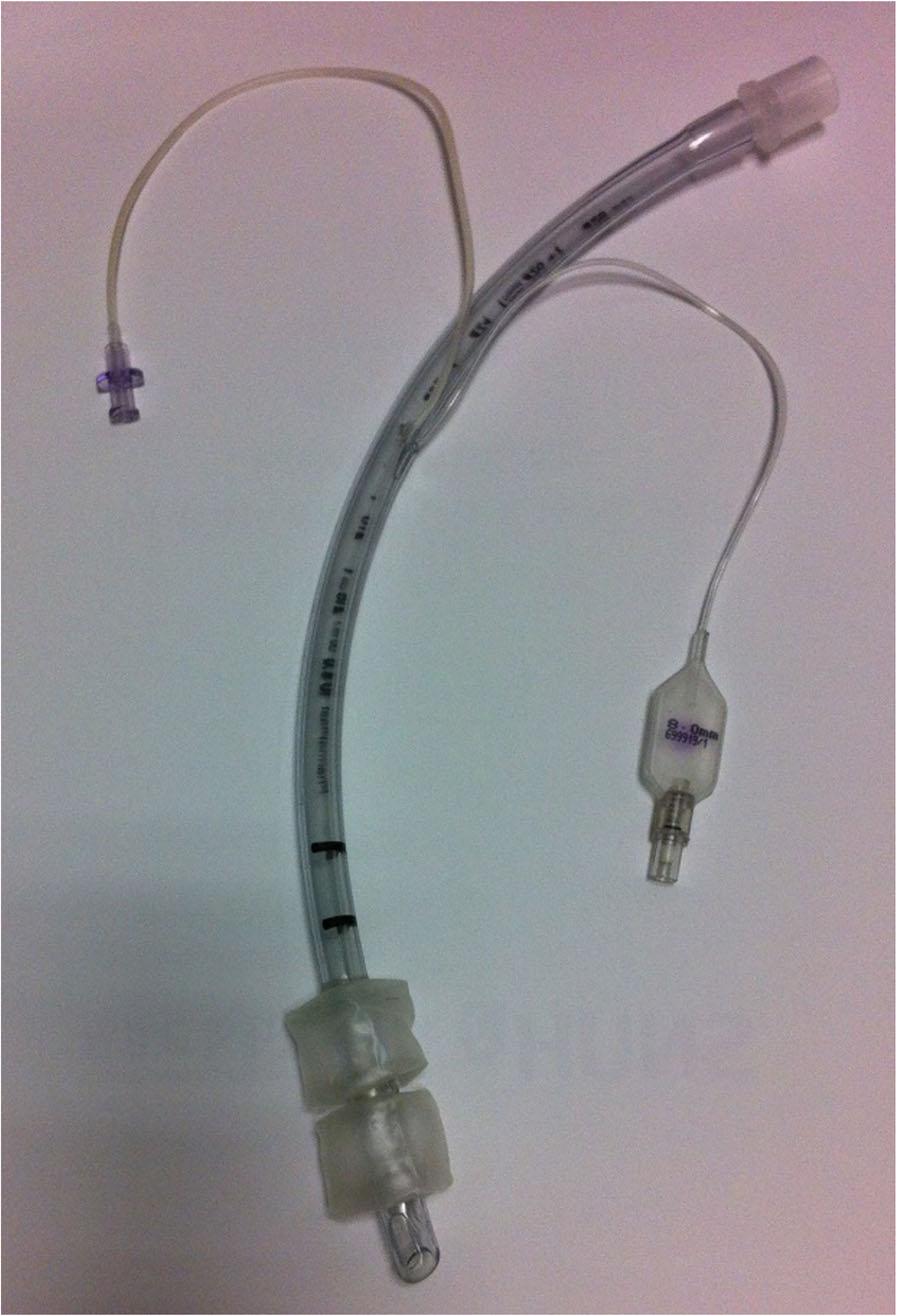 Sohn et al. BMC Anesthesiology (2018) 18:181 Page 2 of 7 Recently, we designed a prototype tracheal tube with double cuffs (Fig.