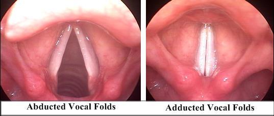 Vocal fold ABDuction -