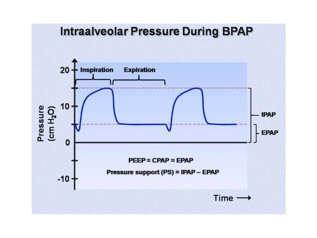 Pressure support systems: Bi