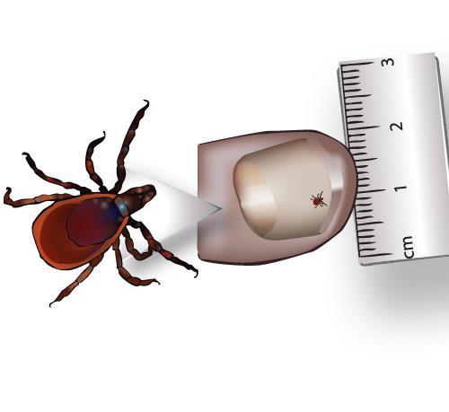 The mouthparts of the tick comprise 2 chelicerae (cutting tools), 2 palps (limbs with sensory organs) and a hypostome, which is a barbed tube that anchors into the flesh of the host.