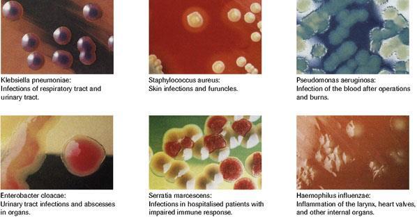What is a pathogen?